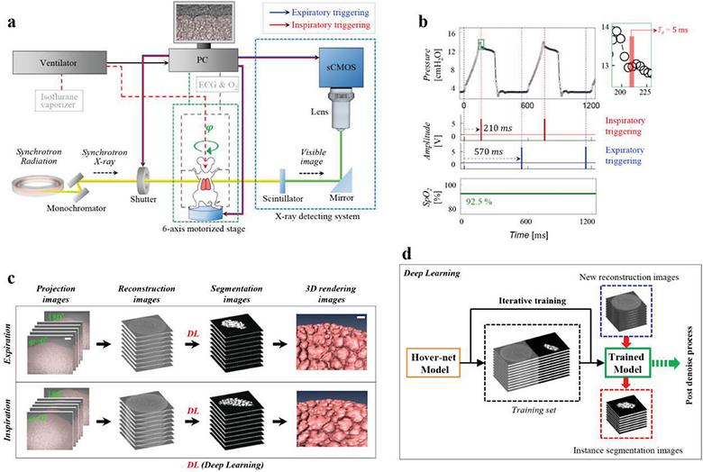 Alveolar Micro-Dynamics during Tidal Ventilation in Live Animals Imaged by SPring-8 Synchrotron